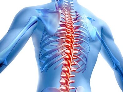 leziune a coloanei vertebrale cu osteocondroză