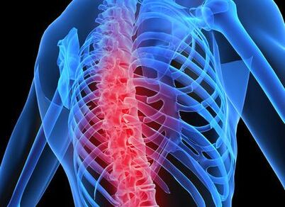 osteocondroza coloanei toracice