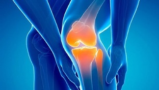 artroza genunchiului