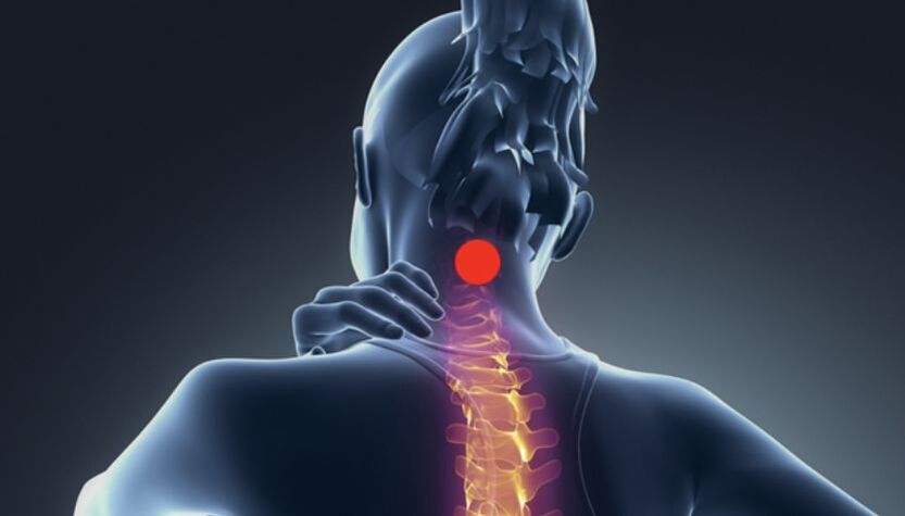 simptome de osteocondroză cervicală